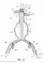 Fig. 08 - Endograft device delivery systems and associated methods