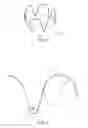 Fig. 04 - Low profile non-symmetrical stent