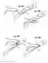 Fig. 22 - Reduced-profile slide and lock stent