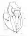 Fig. 01 - Trans-apical implant systems, implants and methods