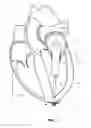 Fig. 02 - Trans-apical implant systems, implants and methods