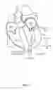 Fig. 08 - Trans-apical implant systems, implants and methods
