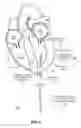 Fig. 09 - Trans-apical implant systems, implants and methods