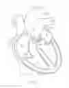 Fig. 02 - Prosthetic Heart Valve System