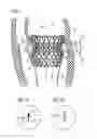Fig. 02 - Transcatheter valve prosthesis