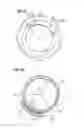 Fig. 07 - Transcatheter valve prosthesis