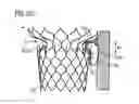 Fig. 11 - Transcatheter valve prosthesis