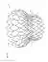 Fig. 14 - Transcatheter valve prosthesis