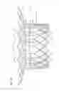 Fig. 16 - Transcatheter valve prosthesis
