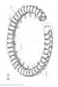 Fig. 32 - Transcatheter valve prosthesis