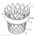 Fig. 01 - Transcatheter valve prosthesis