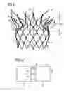 Fig. 03 - Transcatheter valve prosthesis