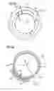 Fig. 07 - Transcatheter valve prosthesis