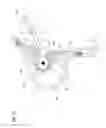 Fig. 37 - Transcatheter valve prosthesis