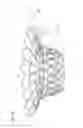 Fig. 20 - Transcatheter valve prosthesis