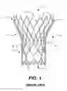 Fig. 02 - Cuff configurations for prosthetic heart valve