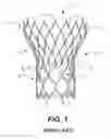 Fig. 02 - Paravalvular leak protection