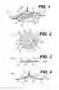 Fig. 02 - Intraocular lens (IOL)