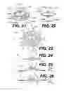 Fig. 06 - Intraocular lens (IOL)