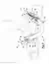 Fig. 05 - Scaffold for spring ligament repair