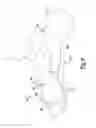Fig. 07 - Scaffold for spring ligament repair