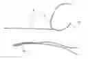 Fig. 01 - Methods of making reinforced soft grafts with suture loop/needle construct