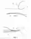 Fig. 02 - Methods of making reinforced soft grafts with suture loop/needle construct