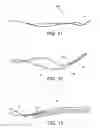 Fig. 08 - Methods of making reinforced soft grafts with suture loop/needle construct