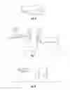 Fig. 07 - APPARATUS AND METHODS FOR AOL AND DRL RECONSTRUCTION OF CMC JOINTS