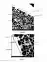 Fig. 02 - Implantable repair device