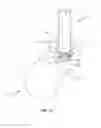 Fig. 06 - Surgical delivery system and method