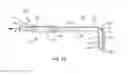 Fig. 09 - Surgical delivery system and method
