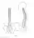 Fig. 02 - IMPLANTS FOR FACET FUSION