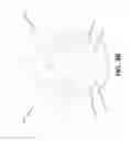Fig. 07 - Expandable coil spinal implant