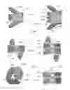 Fig. 09 - Expandable intervertebral implant
