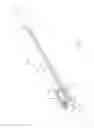 Fig. 06 - Apparatus and methods for inserting an interbody fusion device