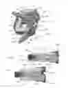 Fig. 02 - Expandable intervertebral implant