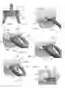 Fig. 06 - Expandable intervertebral implant