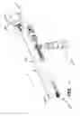 Fig. 33 - Expandable interbody spacer