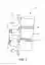 Fig. 02 - Anterior lumbar fusion method and device