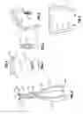 Fig. 03 - Bone staple storage, inserter, and method for use therewith