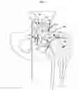 Fig. 02 - Artificial joint components including synovial fluid deflecting structures