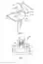 Fig. 02 - System and method for implanting a secondary glenoid prosthesis