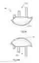 Fig. 13 - Humeral arthroplasty