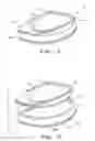 Fig. 02 - FIXATION OF BONE IMPLANTS