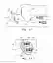 Fig. 09 - FIXATION OF BONE IMPLANTS