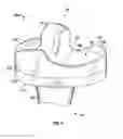 Fig. 07 - Prosthetic knee implant