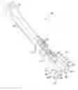 Fig. 01 - Surgical instrument and method of use