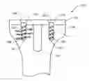 Fig. 01 - Systems and methods for joint repair including subchondral treatment of bone