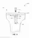 Fig. 07 - Systems and methods for joint repair including subchondral treatment of bone